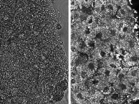 microscopic images of embryo tissue and the scatter correction research method's impact