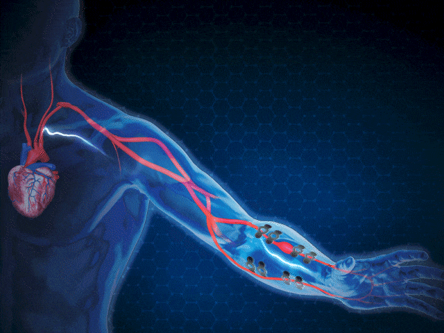 animated illustration of heart pumping electricity through artm
