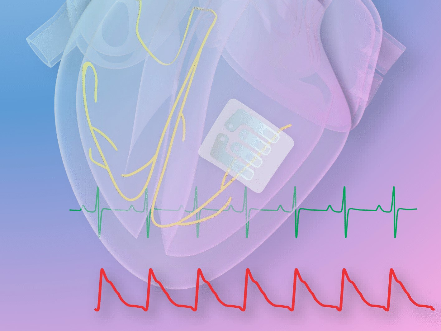 diagram of Deji Akinwande's heart e-tattoo