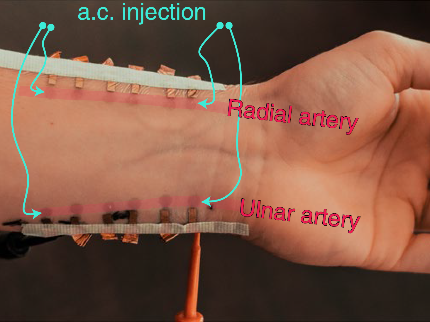 blood pressure e tattoo labeled