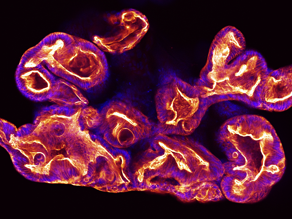 morphology of intestinal organoid